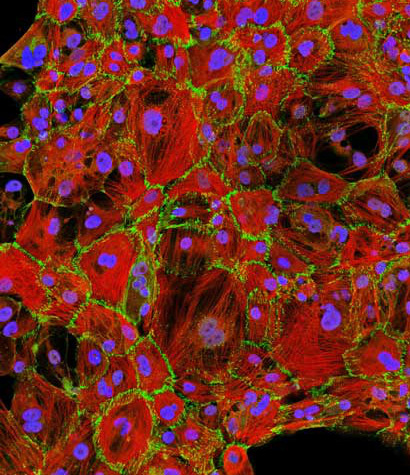 cardiomyocyte
